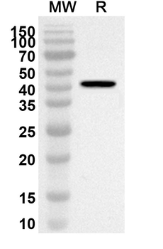 ACVR2A Rabbit Polyclonal Antibody