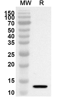 S100P Rabbit Polyclonal Antibody