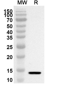 S100A1 Rabbit Polyclonal Antibody