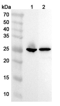 TNNI3 Rabbit Polyclonal Antibody
