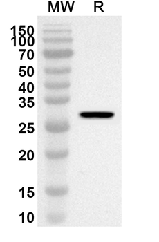 ITGB5 Rabbit Polyclonal Antibody