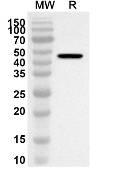 POR Rabbit Polyclonal Antibody