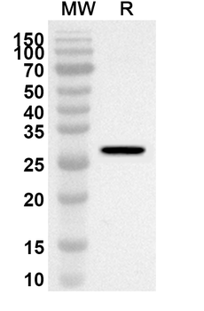 CD119/IFNGR1 Rabbit Polyclonal Antibody