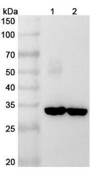 RLBP1 Rabbit Polyclonal Antibody