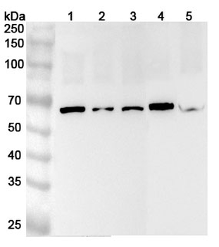 CETP Rabbit Polyclonal Antibody
