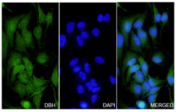 DBH Rabbit Polyclonal Antibody