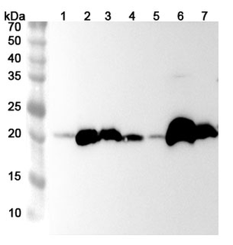 GPX1 Rabbit Polyclonal Antibody