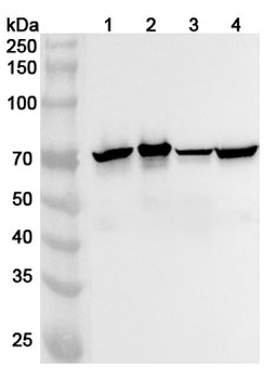 NEFL Rabbit Polyclonal Antibody