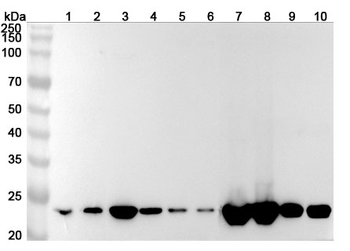 SOD2 Rabbit Polyclonal Antibody