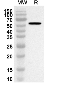CAT Rabbit Polyclonal Antibody