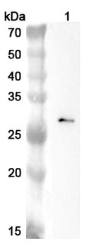 C1QC Rabbit Polyclonal Antibody