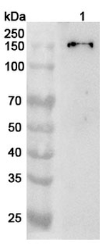 COL2A1 Rabbit Polyclonal Antibody