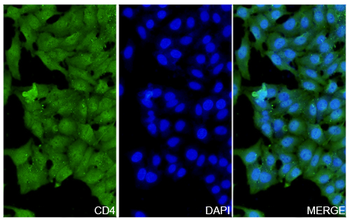 CD4 Rabbit Polyclonal Antibody