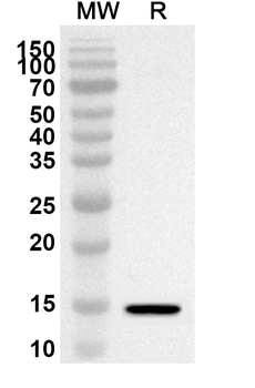 TSHB Rabbit Polyclonal Antibody