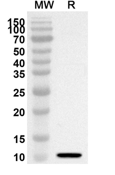 GNRH1 Rabbit Polyclonal Antibody