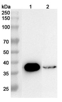 OTC Rabbit Polyclonal Antibody