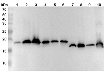 SOD1 Rabbit Polyclonal Antibody