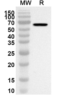 ANXA9 Rabbit Polyclonal Antibody