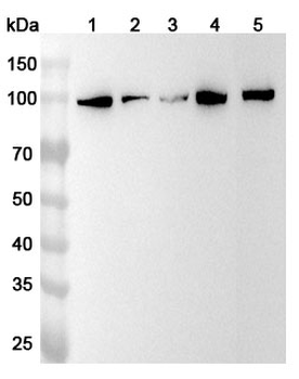 PRDM1 Rabbit Polyclonal Antibody
