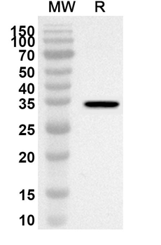 CS Rabbit Polyclonal Antibody