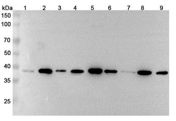 MACROH2A1 Rabbit Polyclonal Antibody