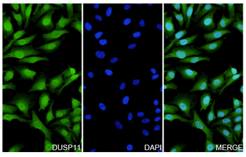 DUSP11 Rabbit Polyclonal Antibody