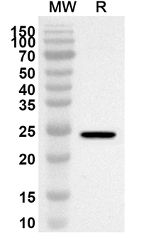 DIAPH1 Rabbit Polyclonal Antibody