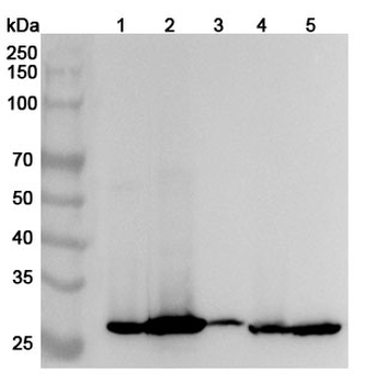 PSCA Rabbit Polyclonal Antibody