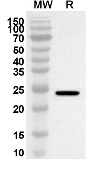 TREH Rabbit Polyclonal Antibody