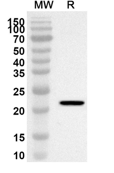 MYL12B Rabbit Polyclonal Antibody