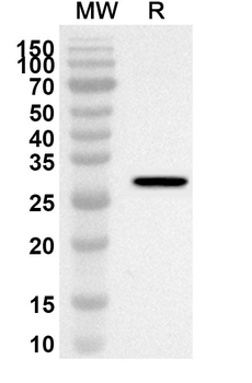 PDHX Rabbit Polyclonal Antibody