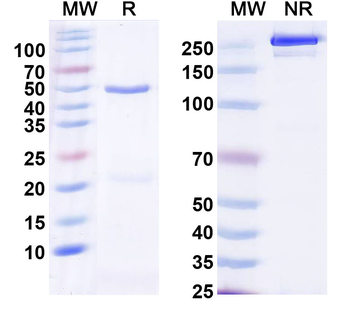 PCT/Procalcitonin Monoclonal Mouse Monoclonal Antibody