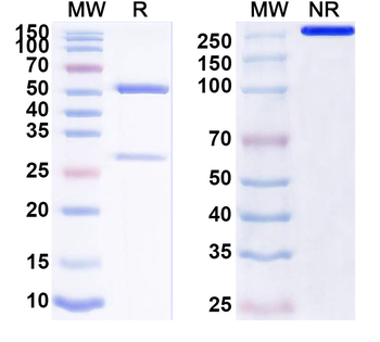 Calprotectin (S100A8/S100A9) Monoclonal Mouse Monoclonal Antibody
