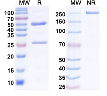HBV HBcAg Monoclonal Mouse Monoclonal Antibody