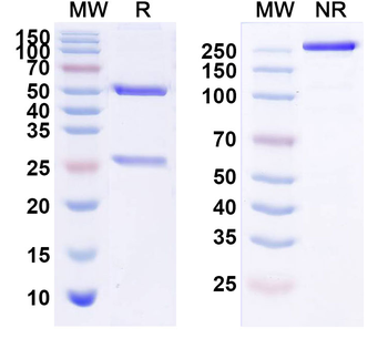 HBV HBsAg Monoclonal Mouse Monoclonal Antibody