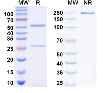 HBV HBsAg Monoclonal Mouse Monoclonal Antibody