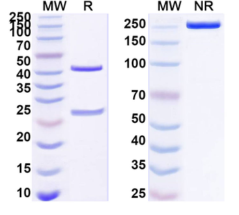 HBV HBsAg Monoclonal Mouse Monoclonal Antibody