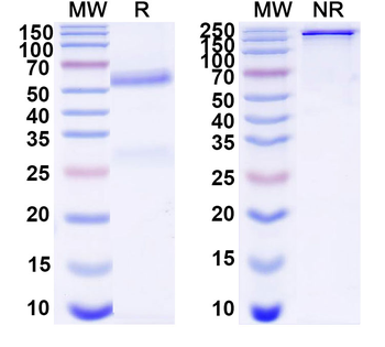 CSFV Envelope glycoprotein E1/gp33 Mouse Monoclonal Antibody