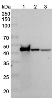 ACTG1 Rabbit Polyclonal Antibody