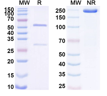 IgE/IGHE Mouse Monoclonal Antibody