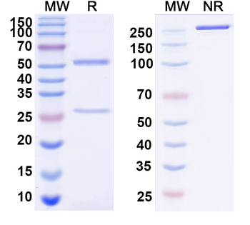 JUNV Glycoprotein GP1 Mouse Monoclonal Antibody