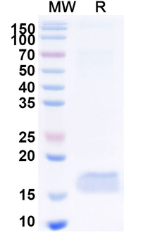 CEP164 Camelus Recombinant Antibody