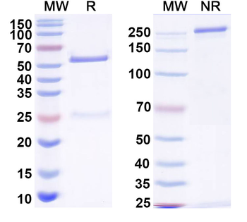HIV1 gp120/Glycoprotein 120 Human Monoclonal Antibody