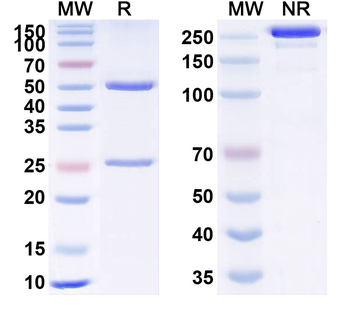 TBL1X IP Mouse Monoclonal Antibody