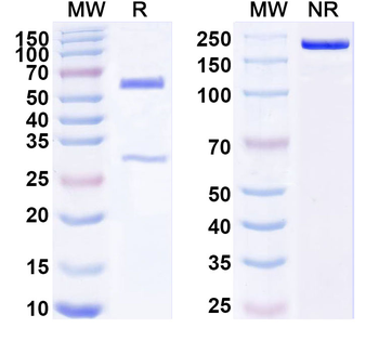 SMYD3 IP Mouse Recombinant Antibody
