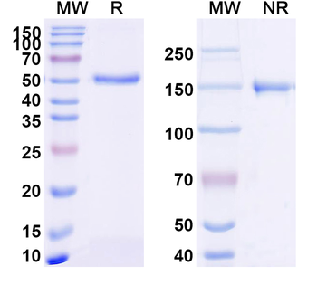 CD229/LY9 Rabbit Recombinant Antibody