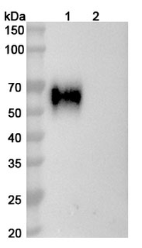 HCV NS1/gp68/gp70/E2 Human Monoclonal Antibody