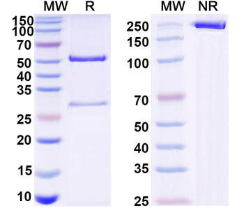 HAV Capsid protein VP2 Human Monoclonal Antibody