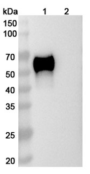 SARS-CoV-2 NP/Nucleoprotein Human Monoclonal Antibody