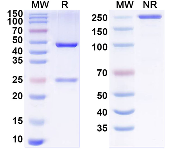 Mycobacterium tuberculosis sodB Human Monoclonal Antibody